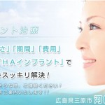 キャプチャ