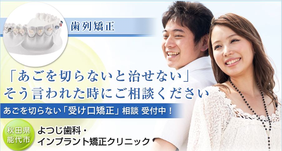キャプチャ