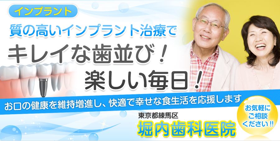 キャプチャ