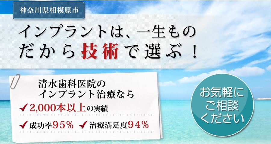 キャプチャ