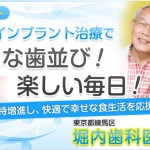 キャプチャ