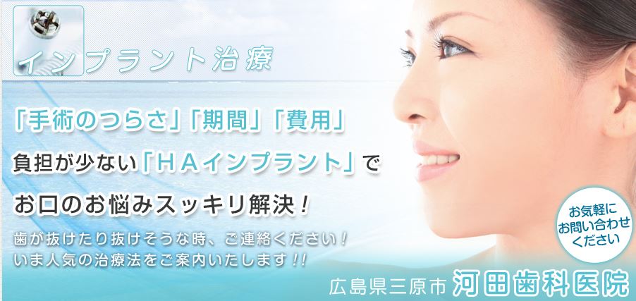 キャプチャ