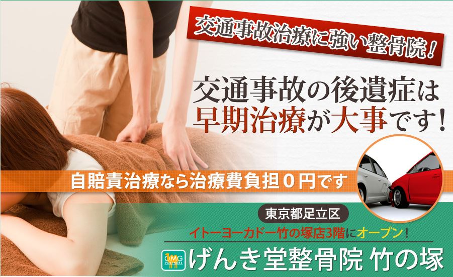 キャプチャ